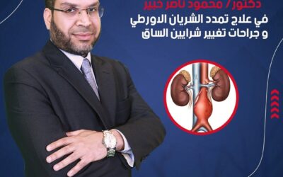 افضل دكتور اوعية دموية