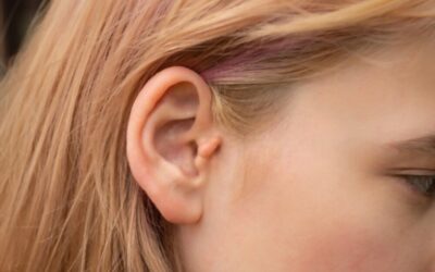 تشوه صيوان الأذن | كل ما تريد معرفته عن تشوهات وصغر حجم صيوان الأذن