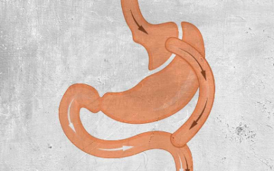 كيف تتم عملية تحويل المسار؟