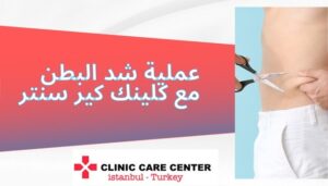 عملية شد البطن