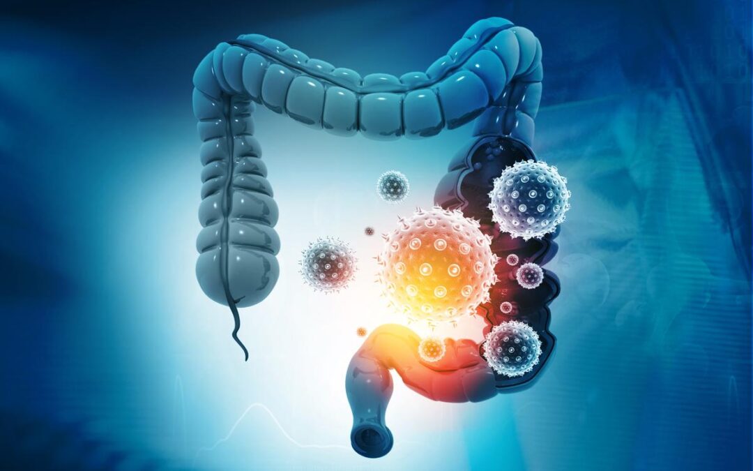 أعراض جرثومة المعدة وطرق علاجها