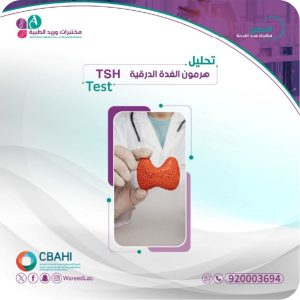 تحليل الغدة الدرقية وأسباب ازدياد الطلب عليه في السعودية – من مختبرات وريد