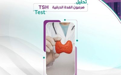 تحليل الغدة الدرقية وأسباب ازدياد الطلب عليه في السعودية – من مختبرات وريد
